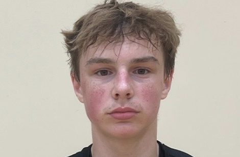 Under the Microscope: What the Film Reveals